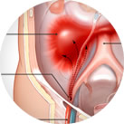 Imagen Retroperitoneo