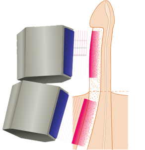 Imagen Ventaja Renova